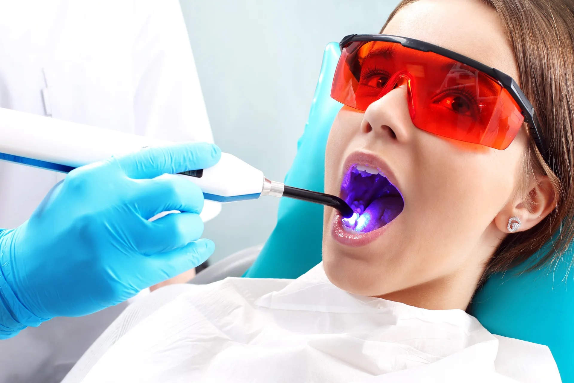 Intra-Oral Cameras