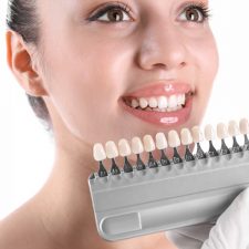Get Your Beautiful Smile Back By Using A Dental Veneer.